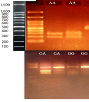 Jundishapur J Microbiol